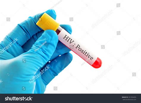 16,242 Hiv Positive Images, Stock Photos & Vectors .